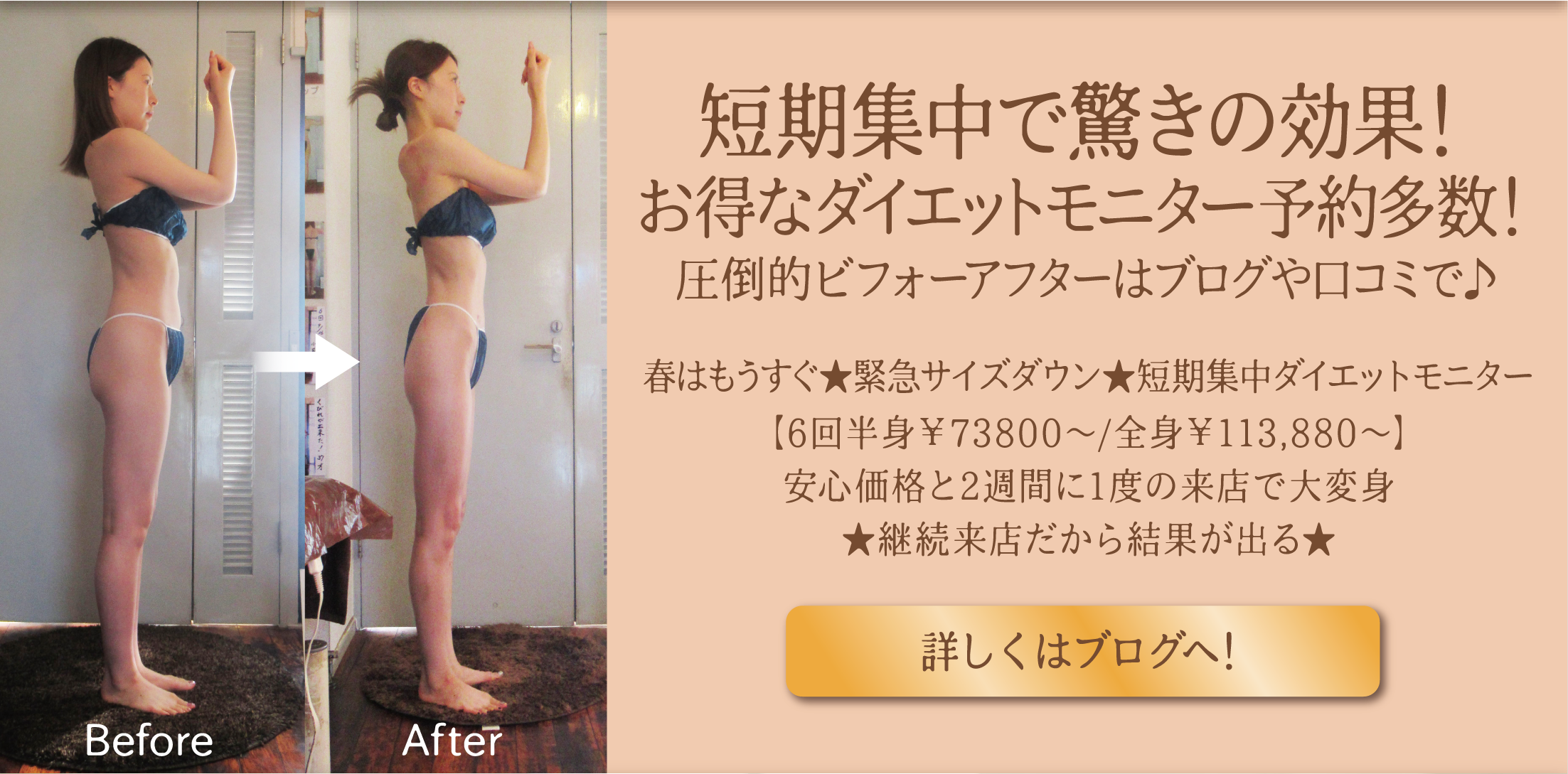 キャンペーン