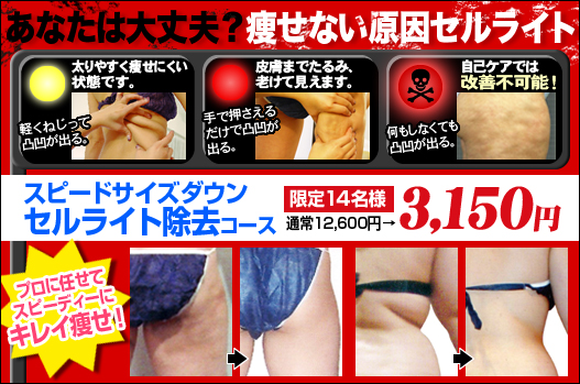 セルライト除去コース