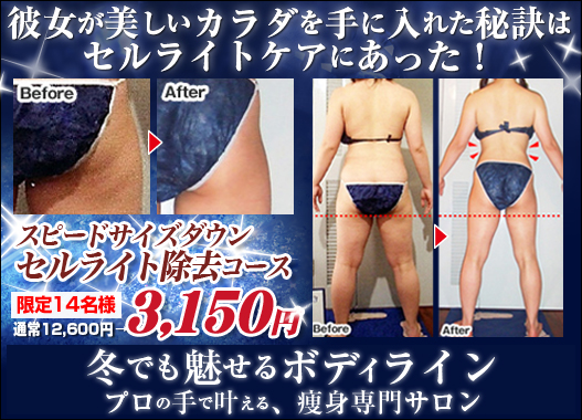 �X�s�[�h�T�C�Y�_�E���R�[�X