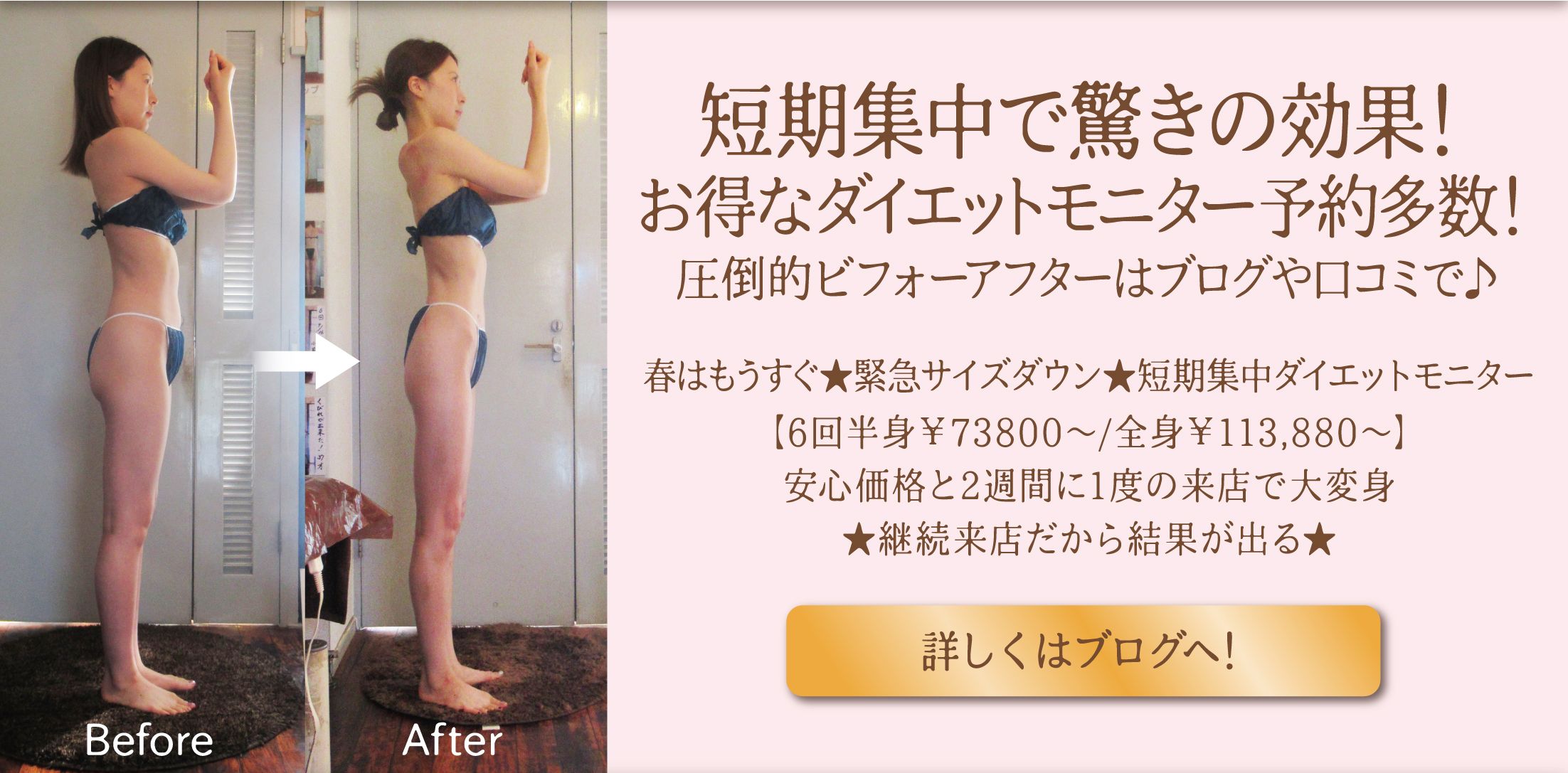 キャンペーン