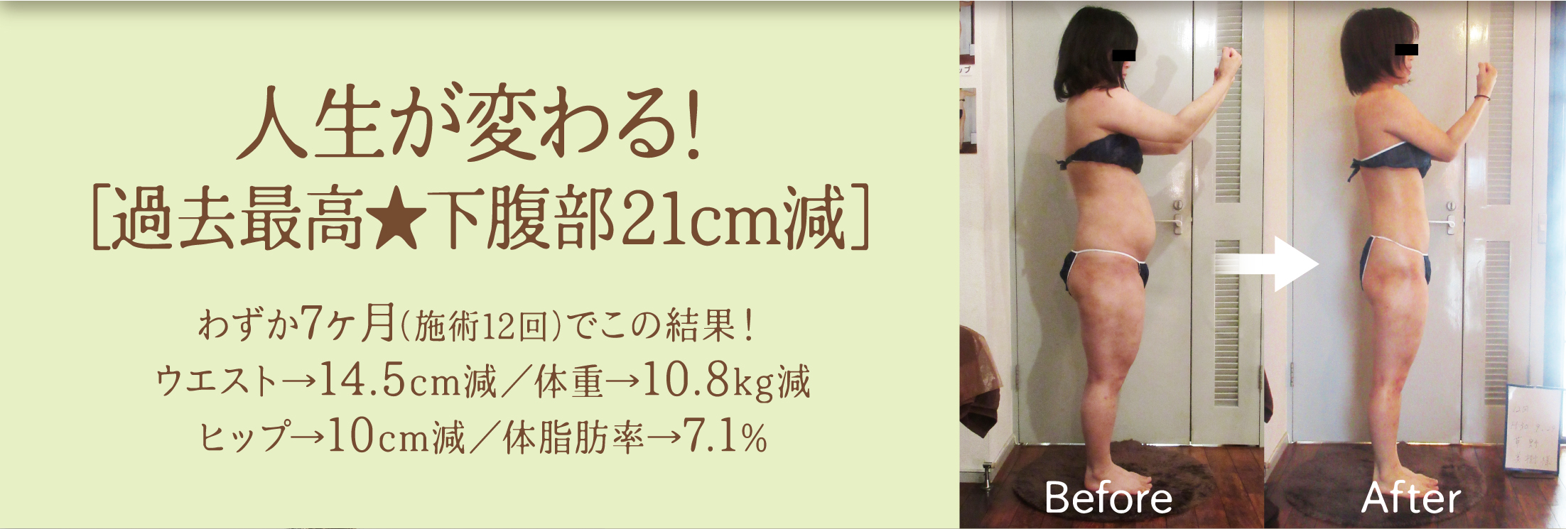キャンペーン